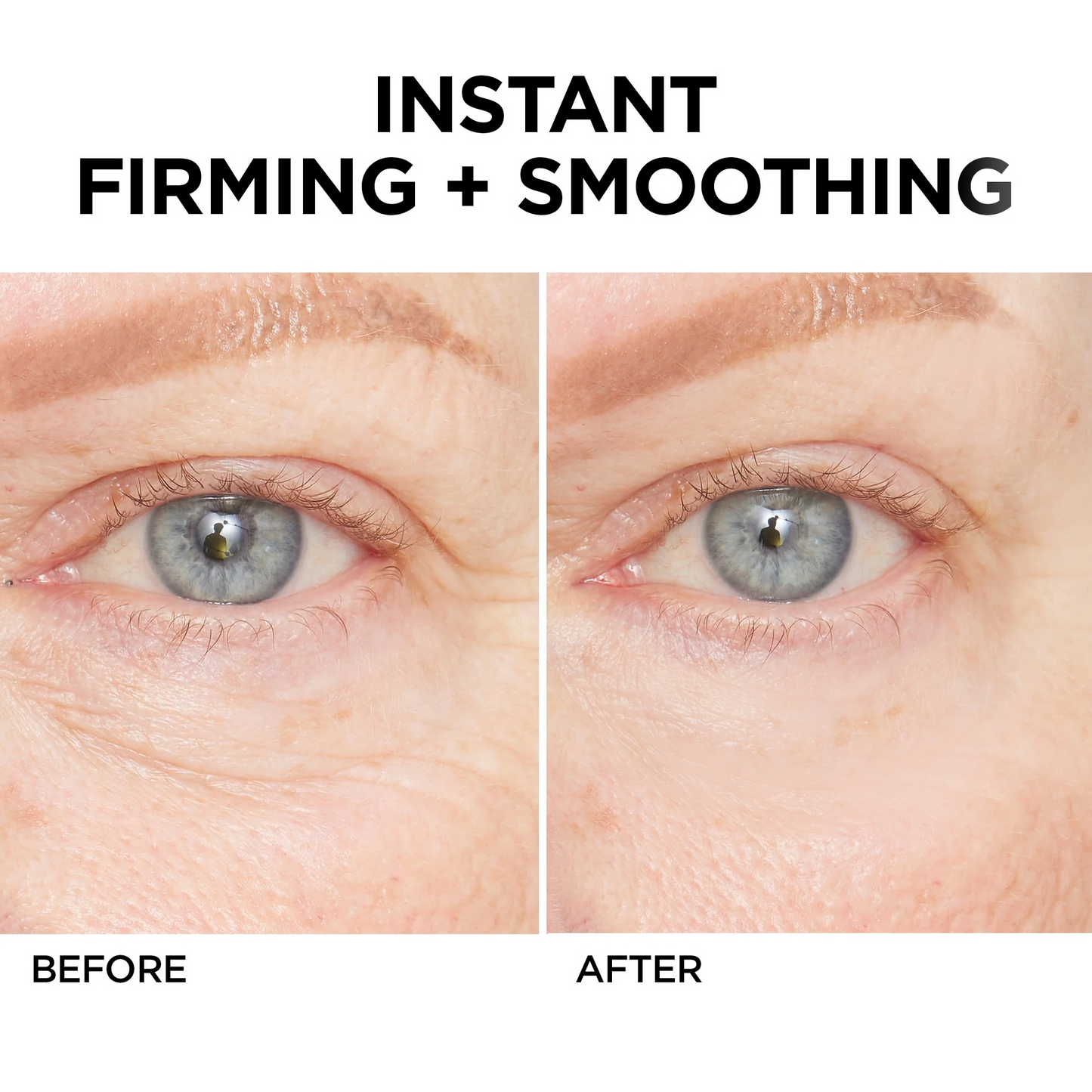 💯Lovilds™🔥Instant Wrinkle Eye Tightener cream