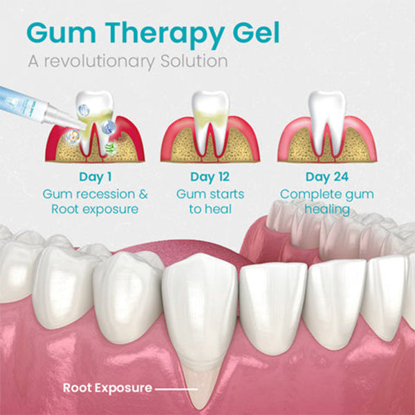 Promoción de último día: 80 % de descuento en gel terapéutico con protector bucal BBOJI™