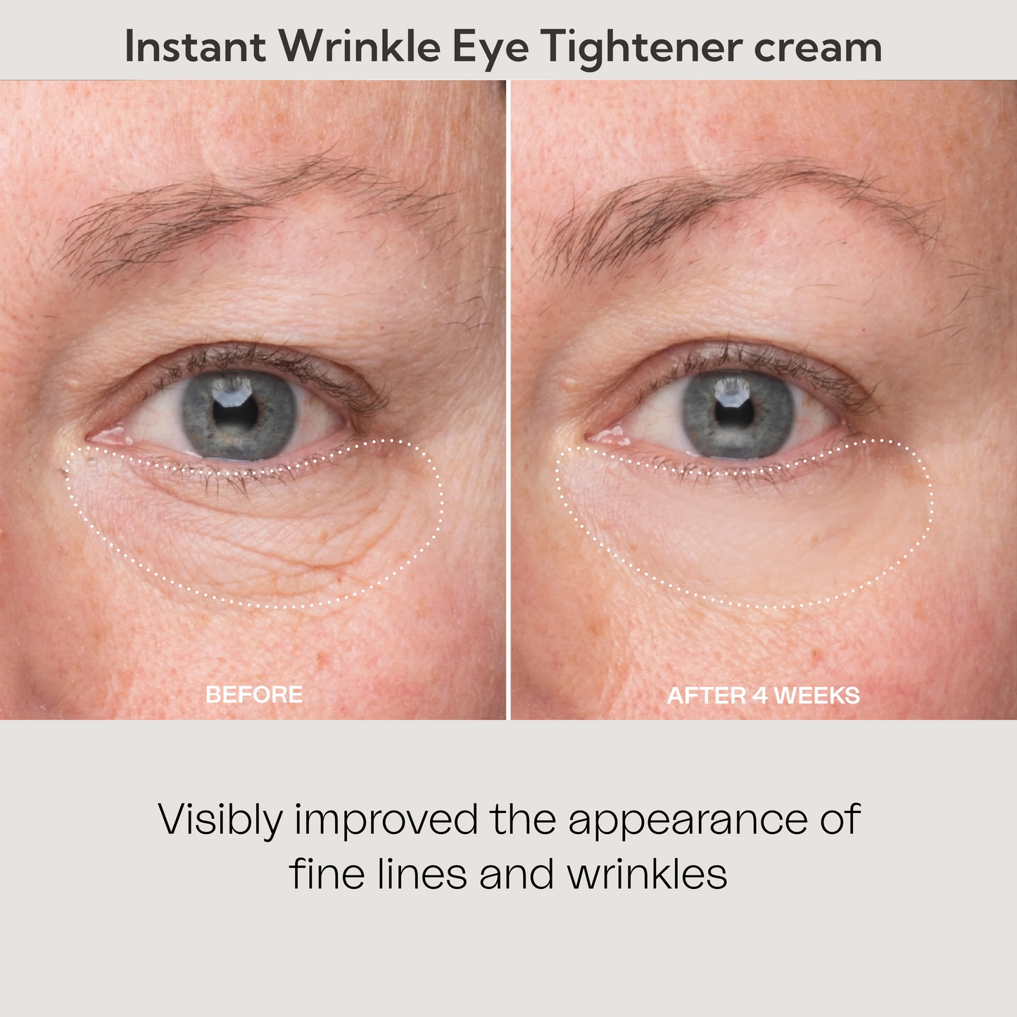 💯Lovilds™🔥Instant Wrinkle Eye Tightener cream