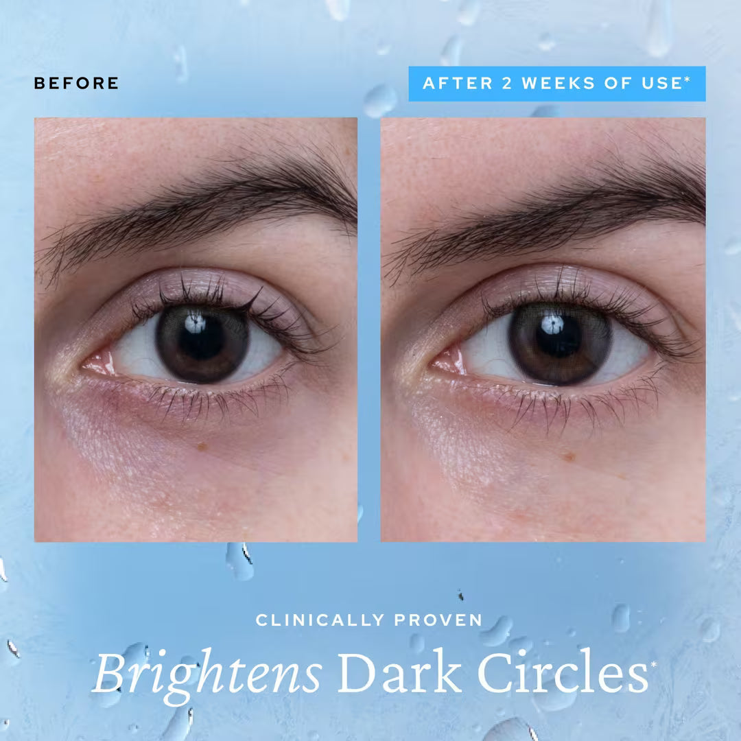 ⚡️【Limited-time Special Offer - Last Day】Ice-Effect Eye Gel! Reduces puffiness in just 3 seconds, making your skin glow even in a plain makeup style!