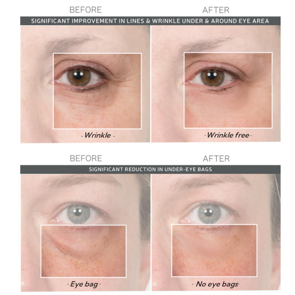 💯Lovilds™🔥Instant Wrinkle Eye Tightener cream