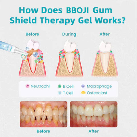 Promoción de último día: 80 % de descuento en gel terapéutico con protector bucal BBOJI™