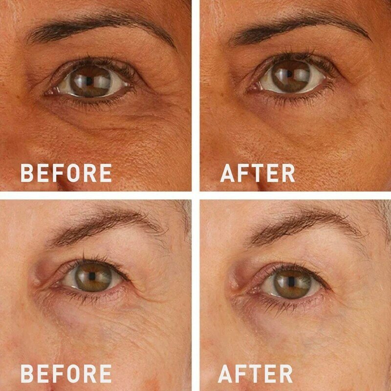 💯Lovilds™🔥Instant Wrinkle Eye Tightener cream