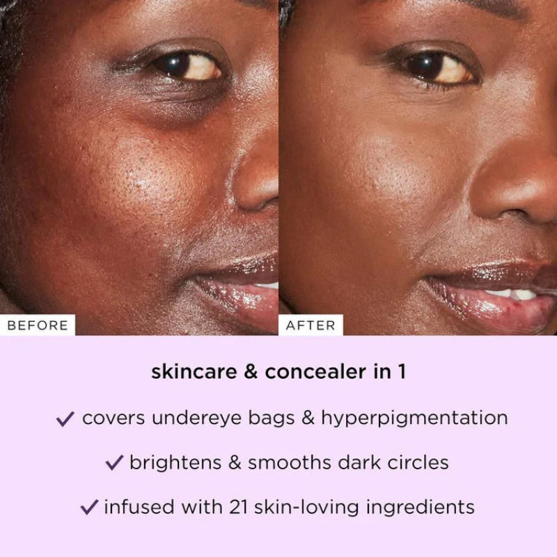 đ§ĄFinal 3 Hours: 70% OFF 1 second to cover acne marks and spots, essential for a natural makeup look!o âshape tape concealer