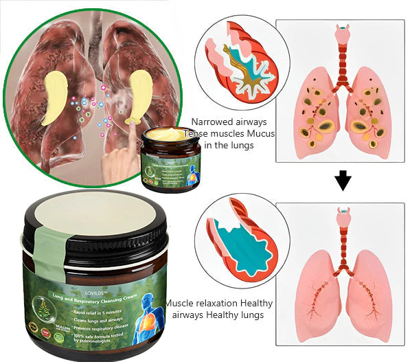 LOVILDS™ Cow’s Lungwort Clear Lung Repair Cream💥💥- Endorsed by the American Thoracic Society to support lung health👑👑.