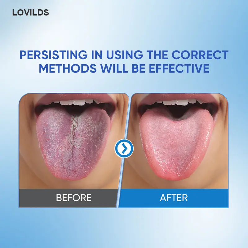 LOVILDS Tongue Cleaning Gel & Tongue Brush, for Cleaner Mouth Reduce Bad Breath