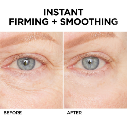 💯Lovilds™🔥Instant Wrinkle Eye Tightener cream