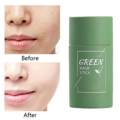 Final Sale（🔥LAST DAY SALE-80% OFF) -LOVILDS™  Green Tea Deep Cleanse Mask