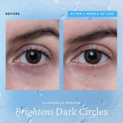 ⚡️【Limited-time Special Offer - Last Day】Ice-Effect Eye Gel! Reduces puffiness in just 3 seconds, making your skin glow even in a plain makeup style!