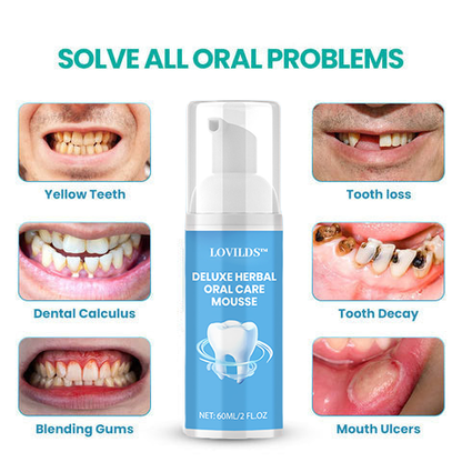 🔥 LAST DAY SALE 70% OFF 🔥LOVILDS™ Deluxe Herbal Oral Care Mousse- Solve all Oral Problems
