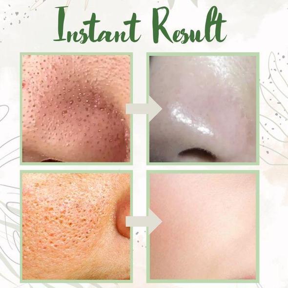 Final Sale（🔥LAST DAY SALE-80% OFF) -LOVILDS™  Green Tea Deep Cleanse Mask