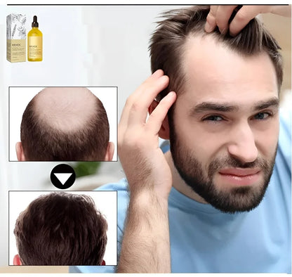 🔥(Último día AHORRE 60 % DE DESCUENTO) LOVILDS™ Esencia para el crecimiento del cabello con romero 100 % natural🌱 
