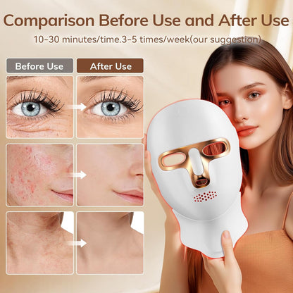 🔥 Early Summer Promotion Final 3 Hours Discount: 80% OFF 🌸Medazy 4D Laser Light Therapy Mask
