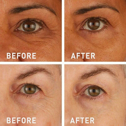 💯Lovilds™🔥Instant Wrinkle Eye Tightener cream