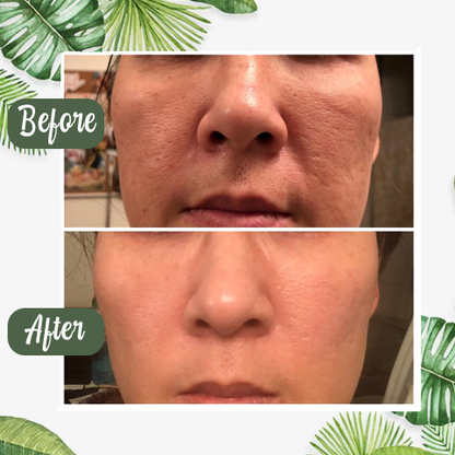 Final Sale（🔥LAST DAY SALE-80% OFF) -LOVILDS™  Green Tea Deep Cleanse Mask
