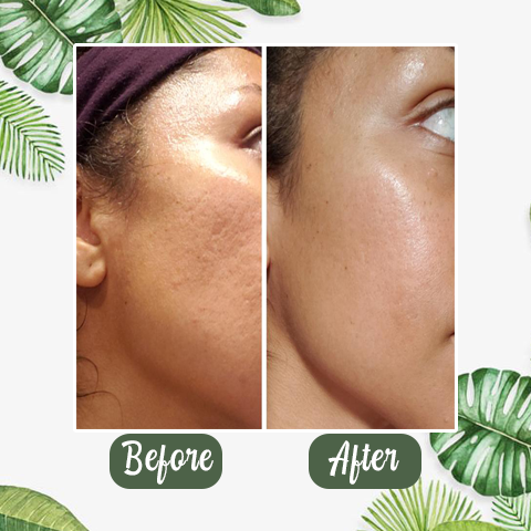 Final Sale（🔥LAST DAY SALE-80% OFF) -LOVILDS™  Green Tea Deep Cleanse Mask