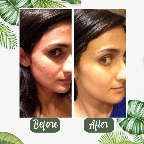 Final Sale（🔥LAST DAY SALE-80% OFF) -LOVILDS™  Green Tea Deep Cleanse Mask