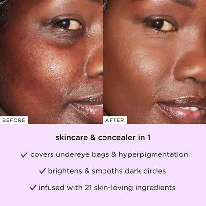 🧡Final 3 Hours: 70% OFF 1 second to cover acne marks and spots, essential for a natural makeup look!o –shape tape concealer
